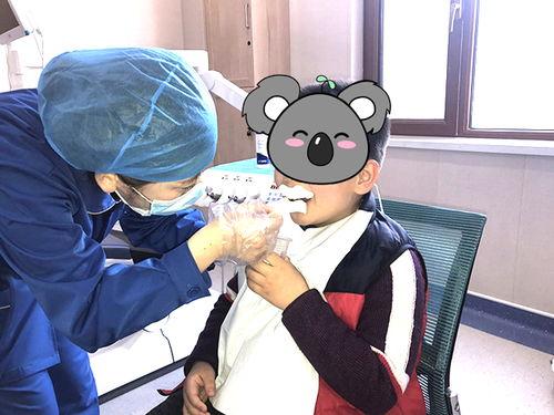 涂氟视频,守护口腔健康
